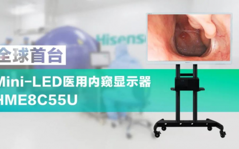 高端医学影像设备海信拔头筹  全球首创背后的中国跃升